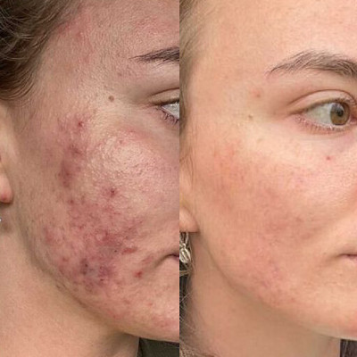 Before and After Image