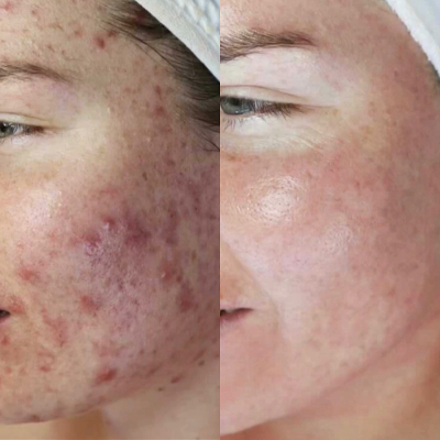 Before and After Image